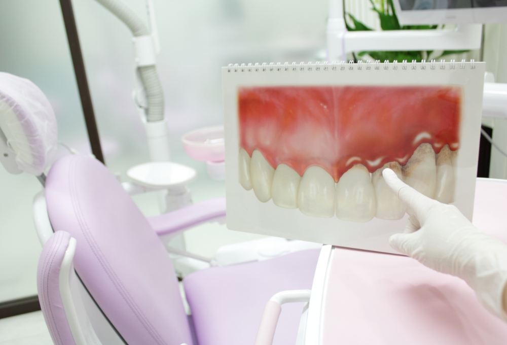 歯周病についてご存知ですか？